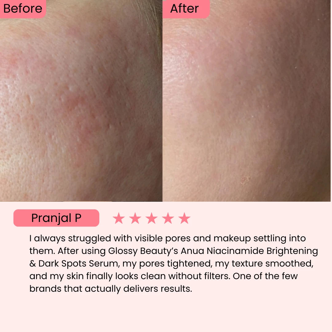 Anua Niacinamide 10% + Txa 4% for Brightening and Dark Spots