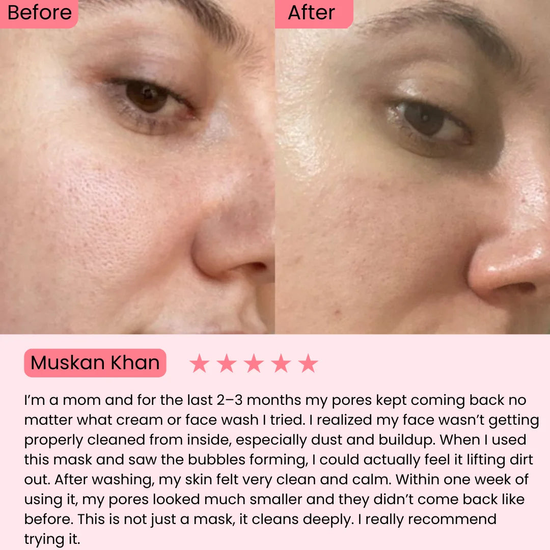 Holy Basil Bubble Deep Mask