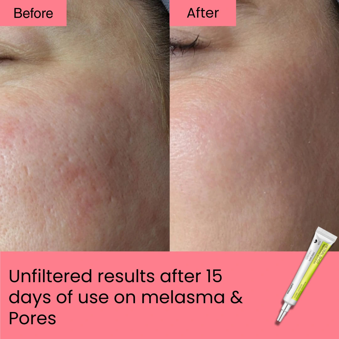 Retinal Shot Tightening Booster