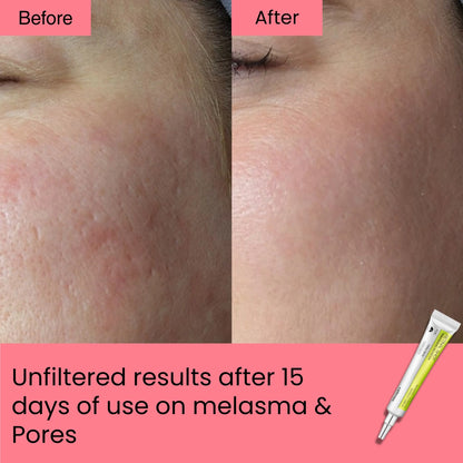 Retinal Shot Tightening Booster