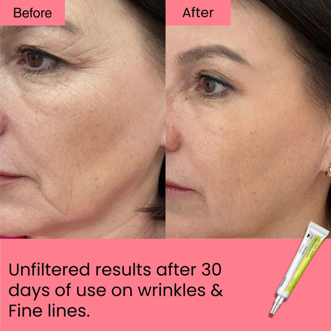 Retinal Shot Tightening Booster