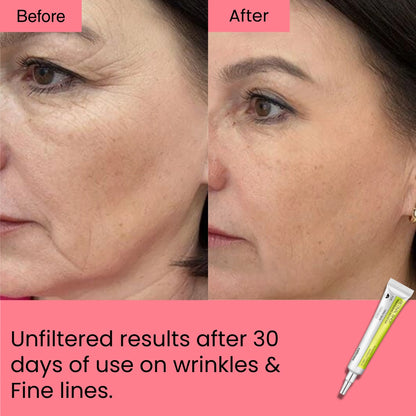 Retinal Shot Tightening Booster