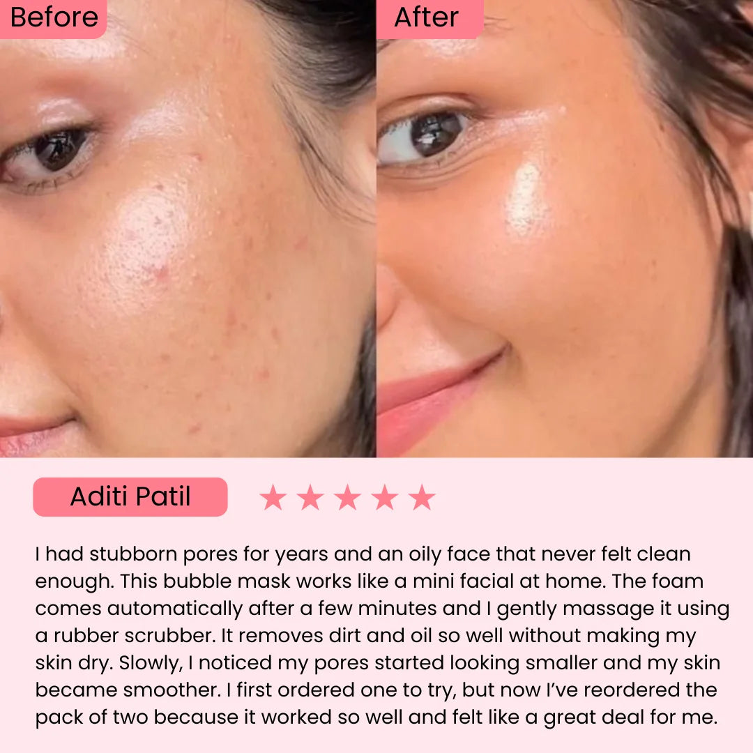 Holy Basil Bubble Deep Mask