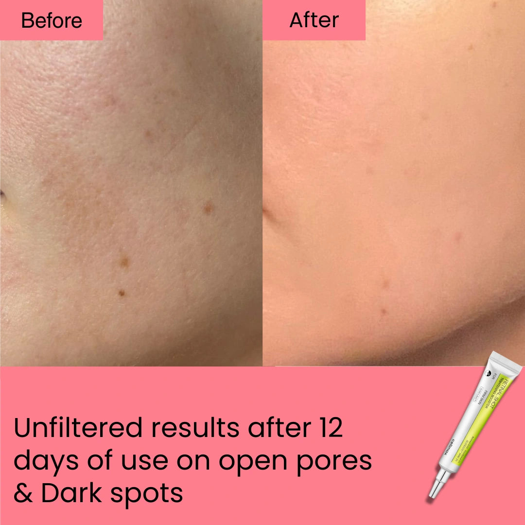 Retinal Shot Tightening Booster