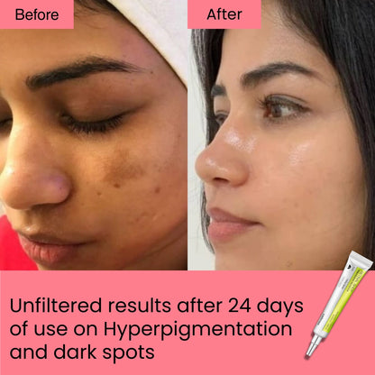 Retinal Shot Tightening Booster