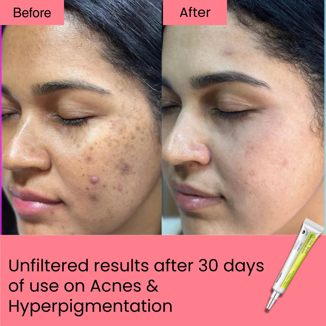 Retinal Shot Tightening Booster