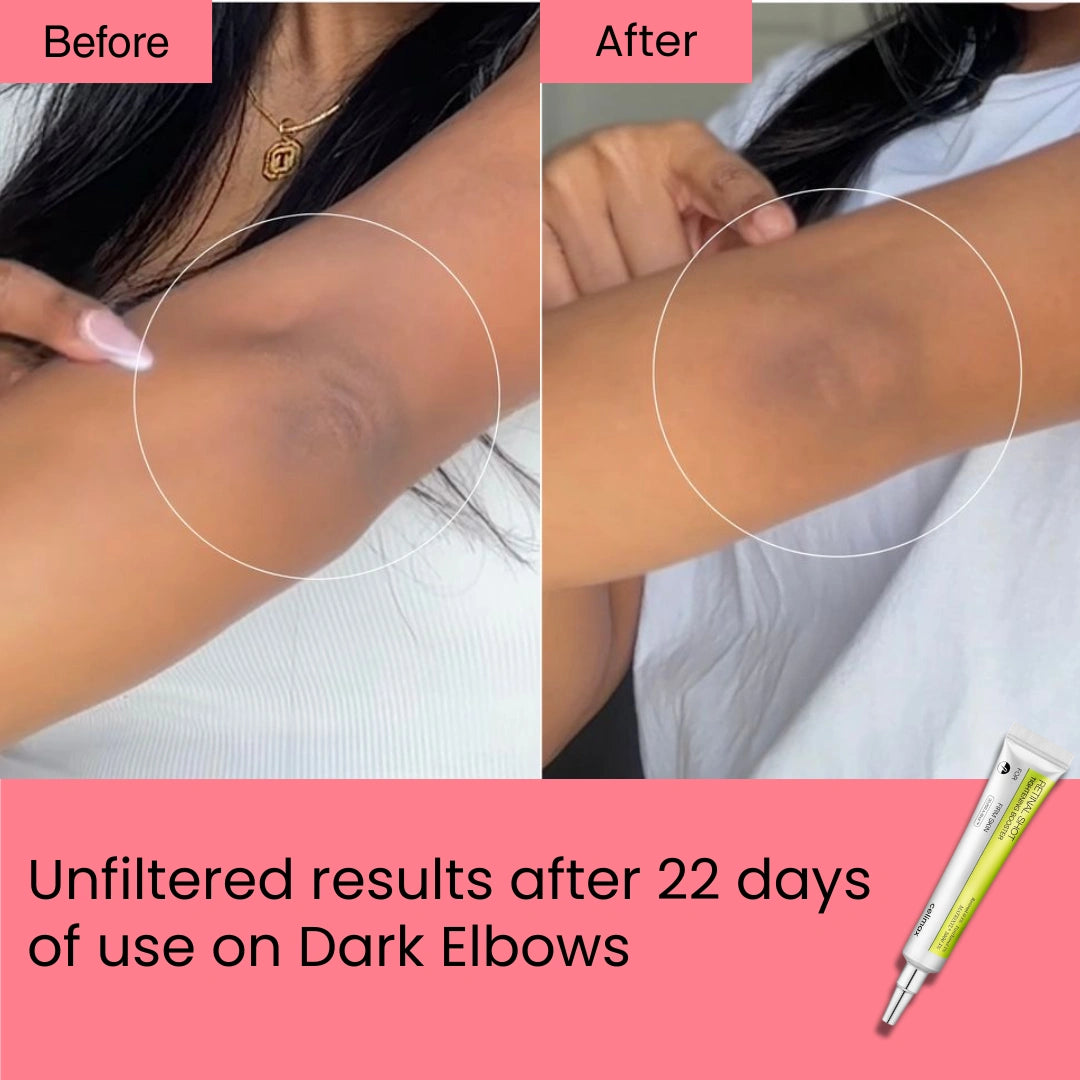 Retinal Shot Tightening Booster