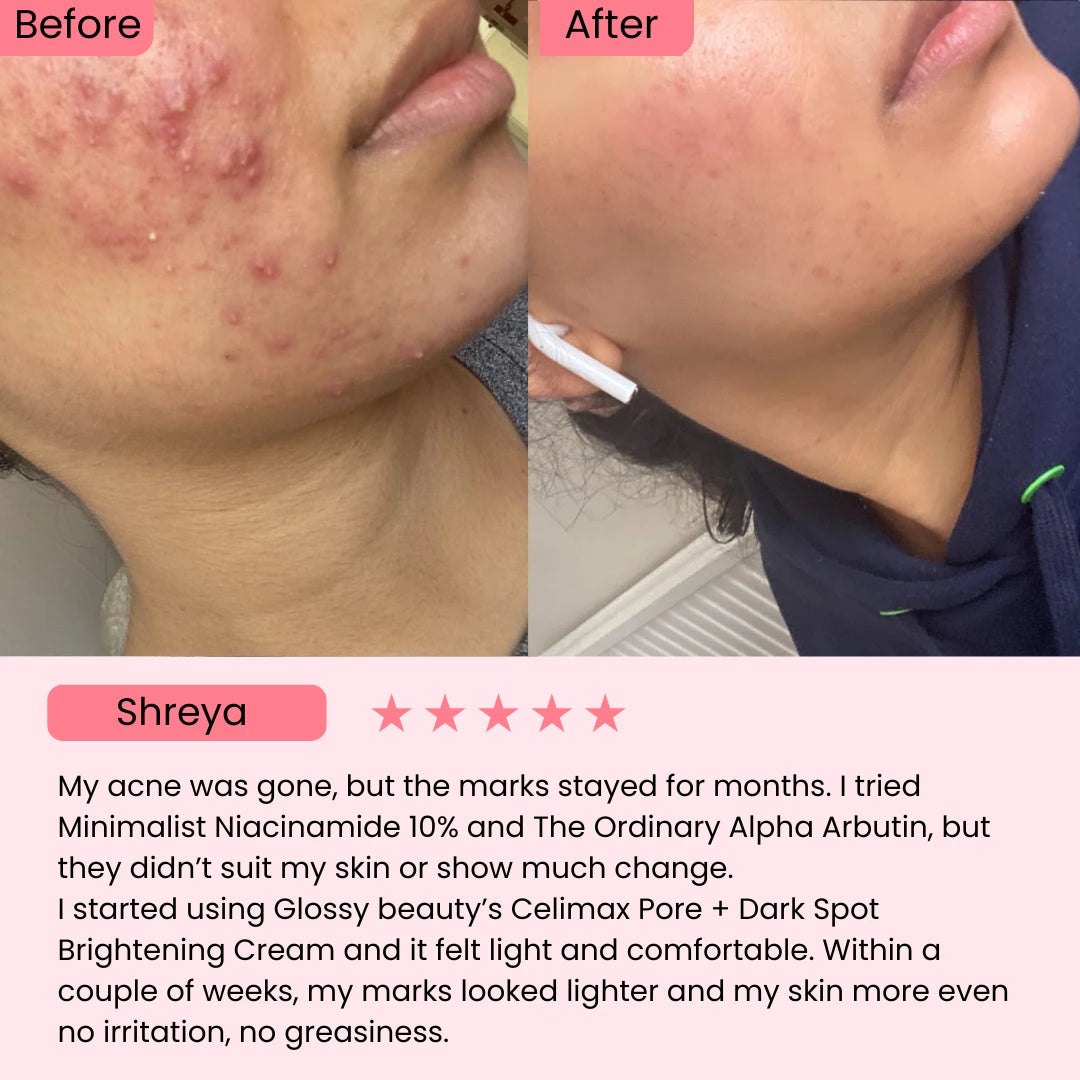 Celimax Pore + Dark Spot Brightening Cream