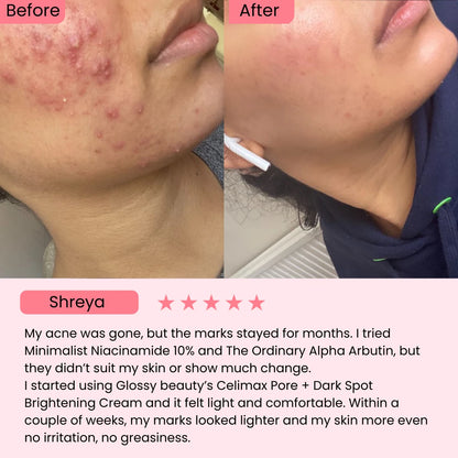 Celimax Pore + Dark Spot Brightening Cream