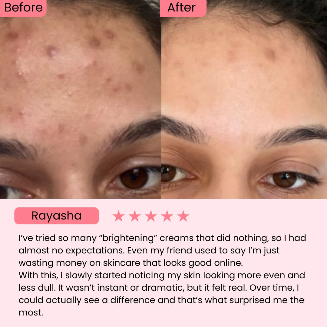 Celimax Pore + Dark Spot Brightening Cream