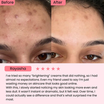 Celimax Pore + Dark Spot Brightening Cream