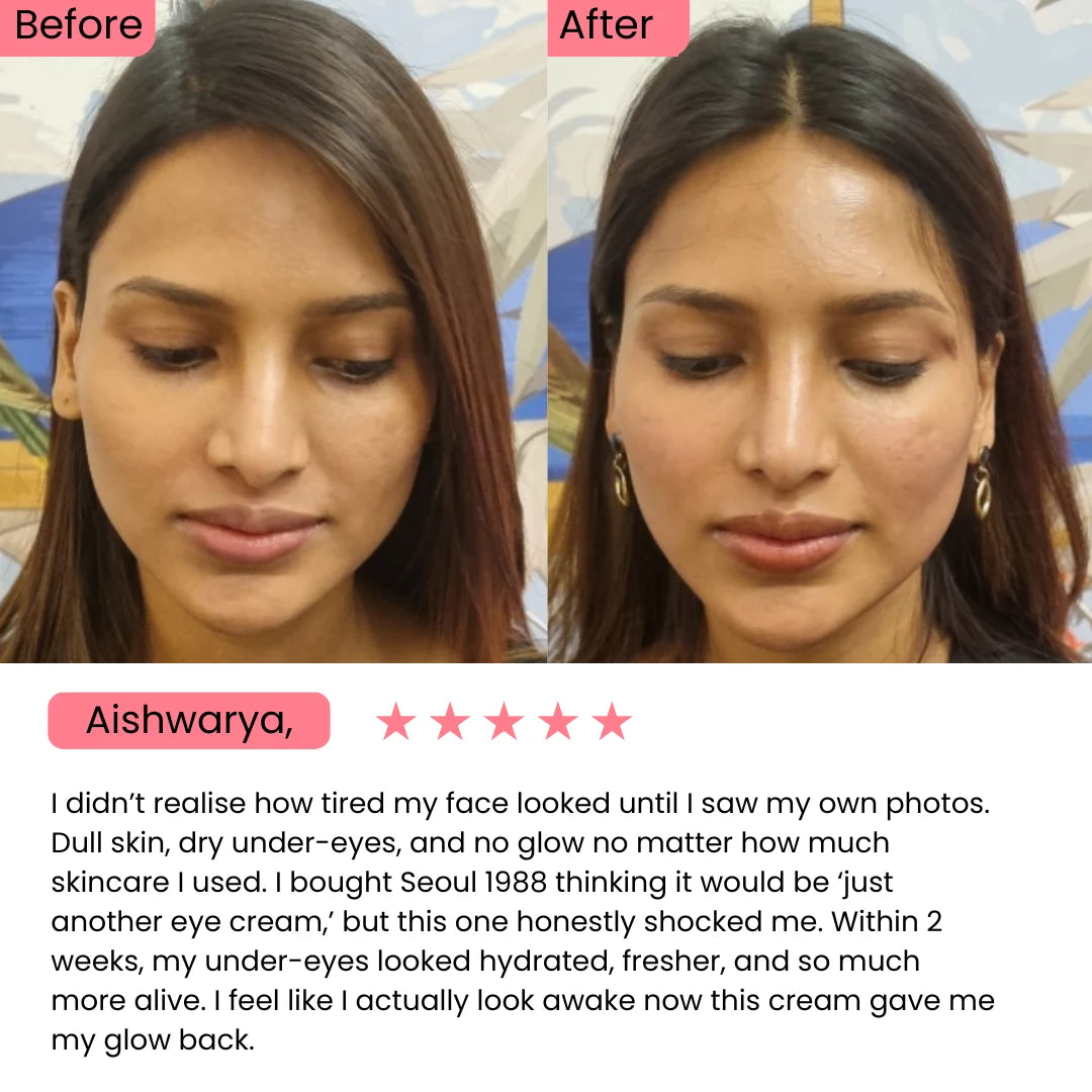 SEOUL 1988 Eye Cream : Retinal Liposome 4% + Fermented Bean