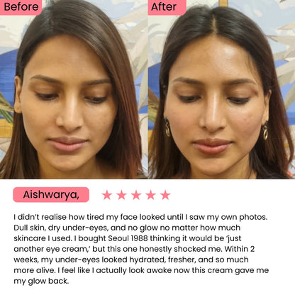 SEOUL 1988 Eye Cream : Retinal Liposome 4% + Fermented Bean