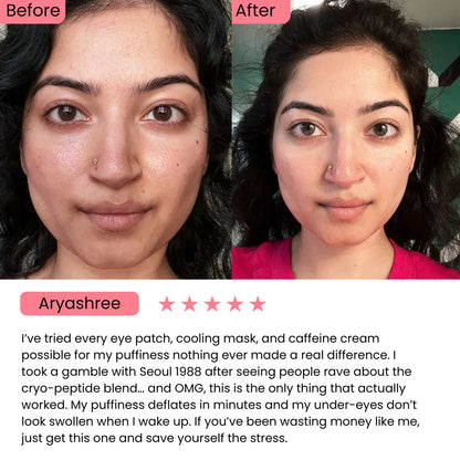 SEOUL 1988 Eye Cream : Retinal Liposome 4% + Fermented Bean