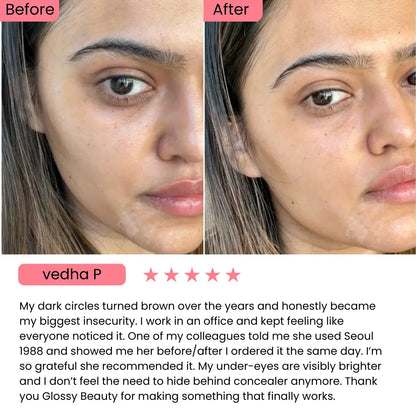 SEOUL 1988 Eye Cream : Retinal Liposome 4% + Fermented Bean