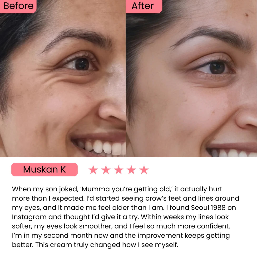 SEOUL 1988 Eye Cream : Retinal Liposome 4% + Fermented Bean