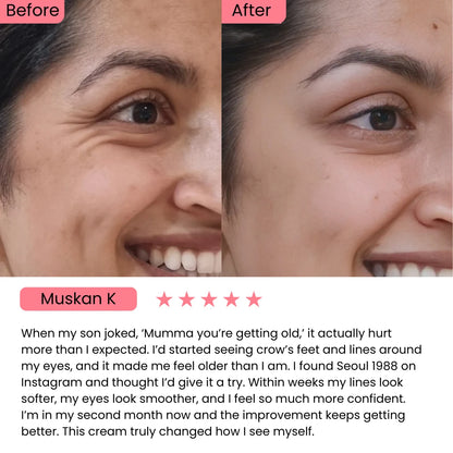 SEOUL 1988 Eye Cream : Retinal Liposome 4% + Fermented Bean