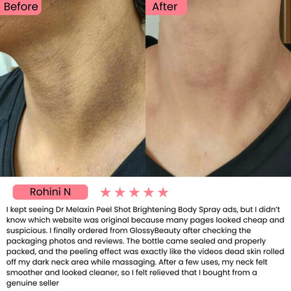 Dr. Melaxin Peel Shot: Brightening Body Spray