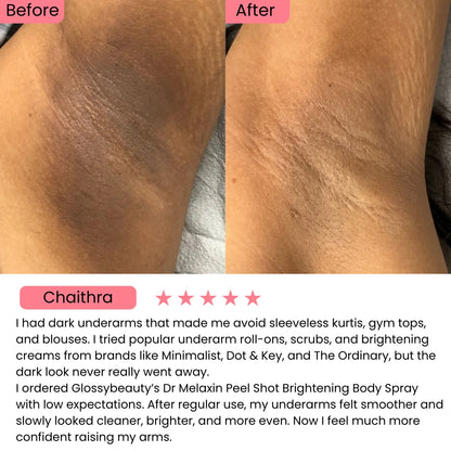Dr. Melaxin Peel Shot: Brightening Body Spray