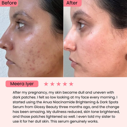 Anua Niacinamide 10% + Txa 4% for Brightening and Dark Spots