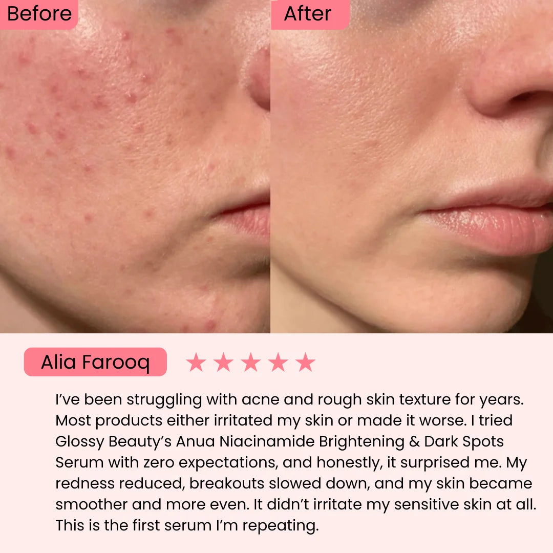 Anua Niacinamide 10% + Txa 4% for Brightening and Dark Spots