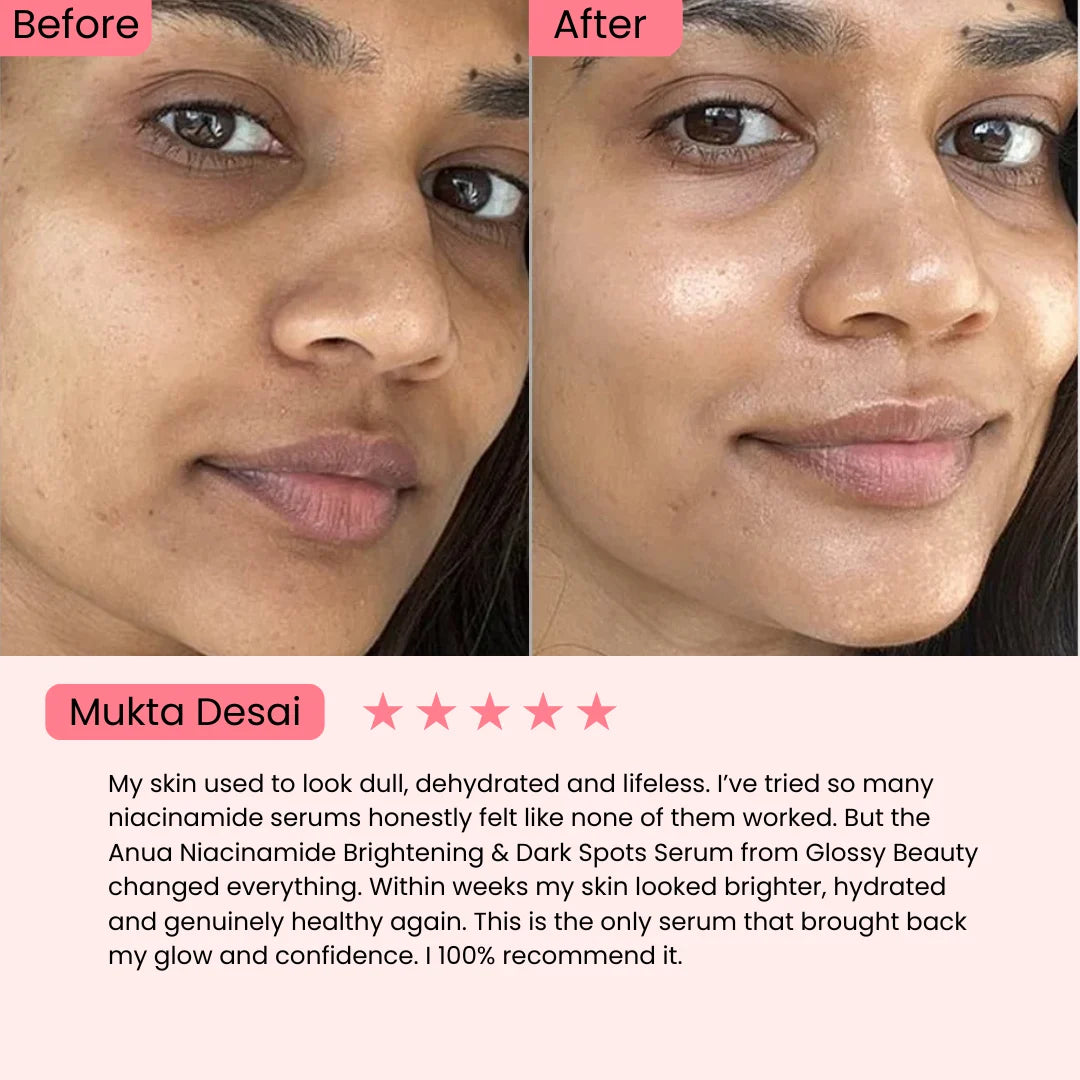 Anua Niacinamide 10% + Txa 4% for Brightening and Dark Spots