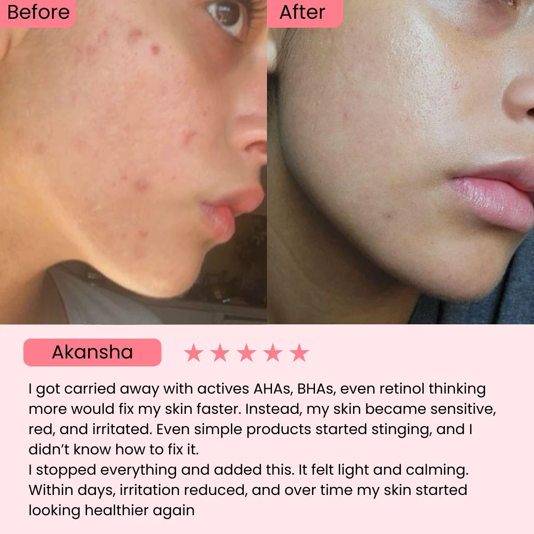 Dr. Althea 345 Relief Cream Mist